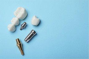 Bird’s eye view of a dental bridge and an implant with its components on a light blue background