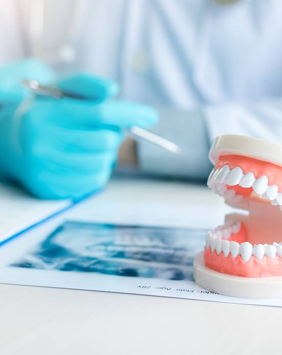 Model of denture sitting on X-ray on dentist's desk